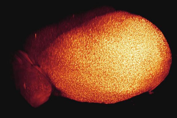 Die hellen Punkte sind Beta-Amyloid-Plaques im Gehirn einer Maus. Sie werden für die Entstehung der Alzheimer-Krankheit verantwortlich gemacht.