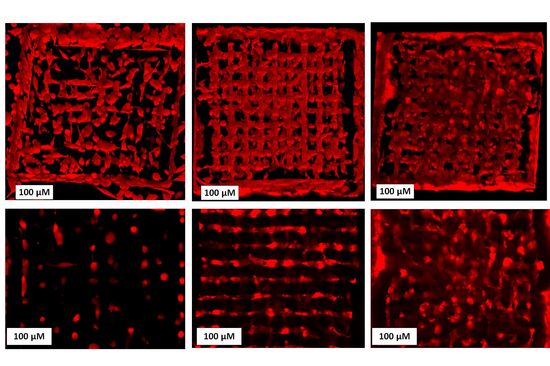 Cells spreading in a 3D scaffold - from left to right: week 1, week 3 week 5. Top: 3D setup, bottom: one layer only. 