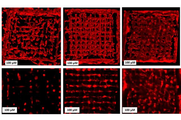 Cells spreading in a 3D scaffold - from left to right: week 1, week 3 week 5. Top: 3D setup, bottom: one layer only.