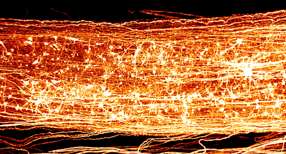 3D-Rekonstruktion eines Mäuserückenmarks