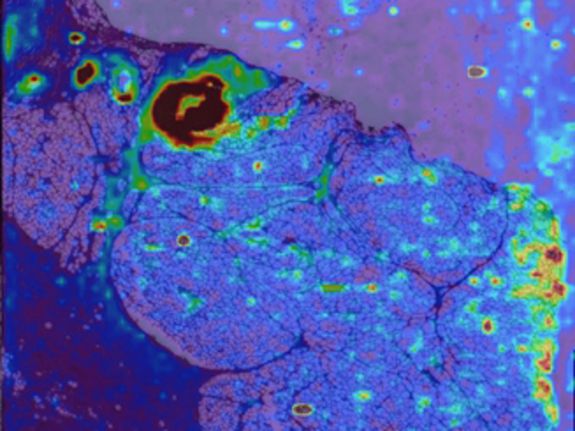 Modernes Bio-Imaging: Die Verteilung des Isotops Zink 68 in einem Gewebeschnitt. Foto: A. Limbeck