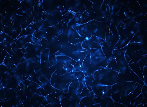 [Translate to English:] Im Biochip gezüchtete menschliche Gefäßsysteme