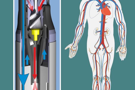 A Customizable Intravascular Device for Controlled Mass Exchange