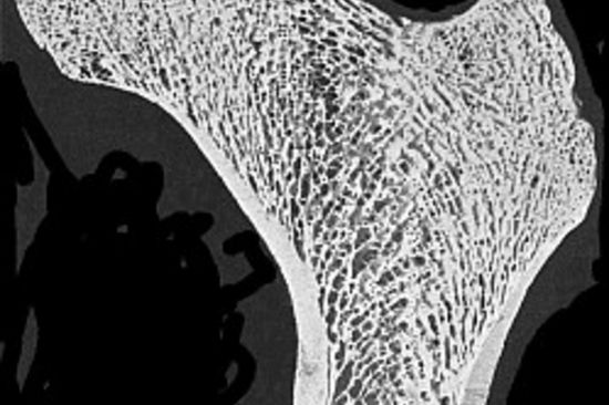 Abb.1: Querschnitt durch einen menschlichen Oberschenkelknochen