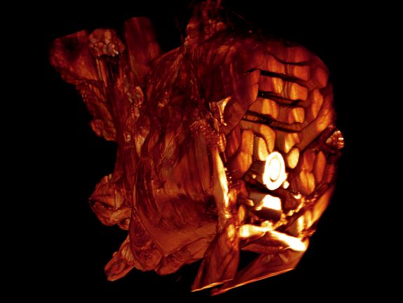 Ultra-microscopic image of a drosophila's thorax Ultra-microscopic image of a drosophila's thorax