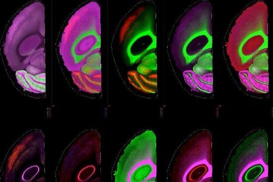 Aufnahmen aus dem Inneren eines Rattengehirns
