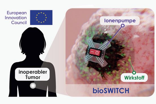Schematische Darstellung einer winzigen Pumpe, eingebaut im Körper