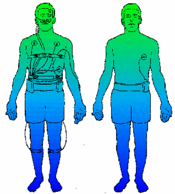 Abb.4: Vorteil der Innovation: nur ein Sensor!