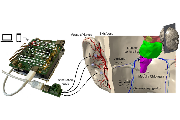Sketch showing how the aVNS system is connected to the brainstem via the nerve tracts.