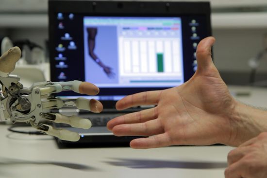 Bionische Rekonstruktion einer Hand 