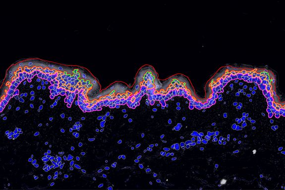 Mikroskopaufnahme von Hautzellen