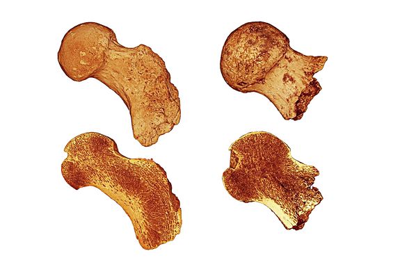 3D-gescannte Knochen