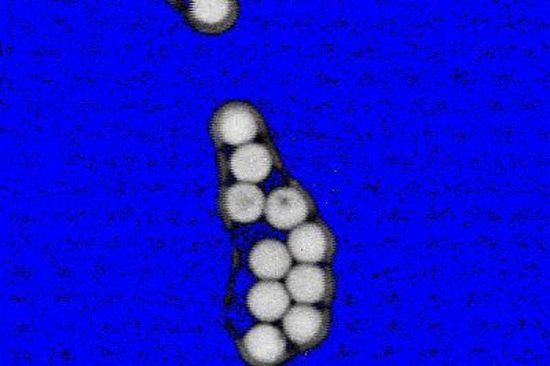 Dynamic Background Compensation for Fluorescent Microscopy - Background light that typically contaminates a fluorescent image is removed.   Photos what it looks like:  Left = undisturbed image, Middle = image disturbed by a pulsed optogenetic LED during acquisition, Right =  compensated image  - with link to PDF "Dynamic Background Compensation for Fluorescent Microscopy"