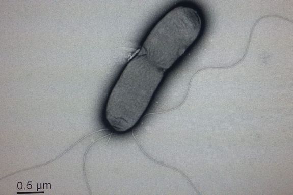 [Translate to English:] Mikroskopaufnahme eines Bakteriums