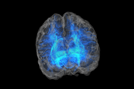 MRI phantom for determination of the direction of nerve fibers in the brain