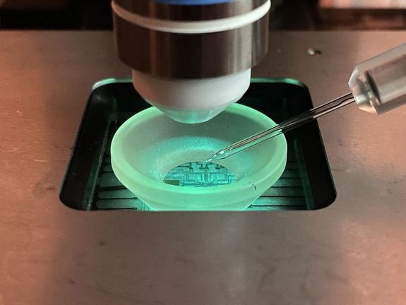 [Translate to English:] Nervenzellen_blinder_Maeuse_2