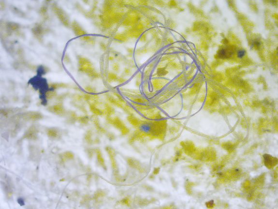 Mikroplastik aus dem Meer Mikroplastik aus dem Meer