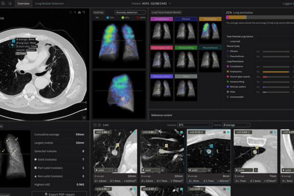 Bildschirm, schwarz, mit verschiedenen Röntgenbildern und Ansichten einer Lunge.