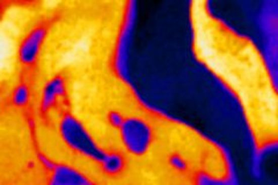 Blaue und orange zonen