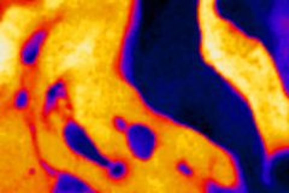 Blaue und orange zonen