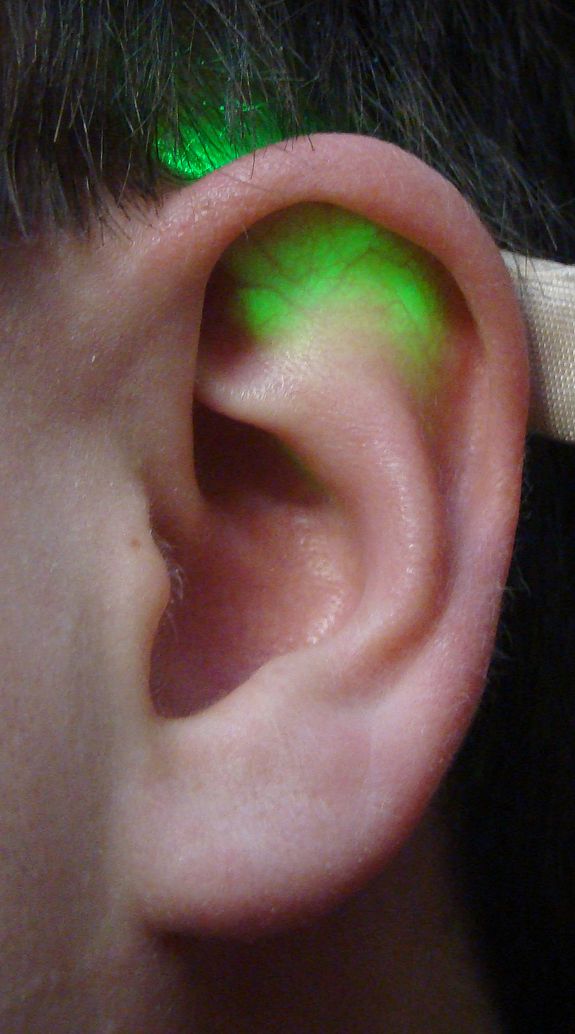 Um die richtigen Einstichstellen zu finden, wird das Ohr durchleuchtet.