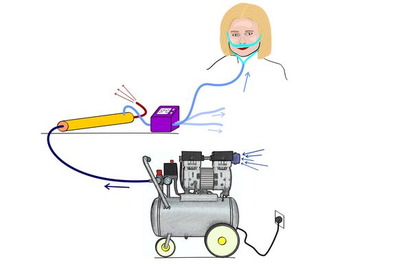 So funktioniert das neue Sauerstoffgerät