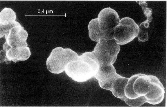 Elektronenmikroskopie-Aufnahme eines Russpartikels