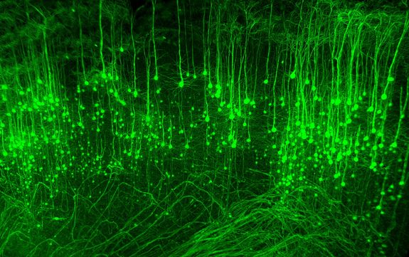 Fluoreszierende Gehirnzellen, abgebildet mit dem Ultramikroskop der TU Wien